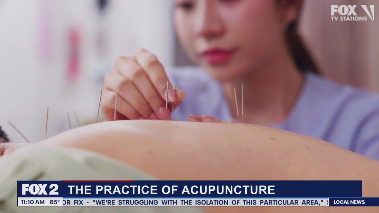 Lori's Stories Acupuncture part 1